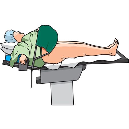 Pannus Support Pannus Support - Color Varies