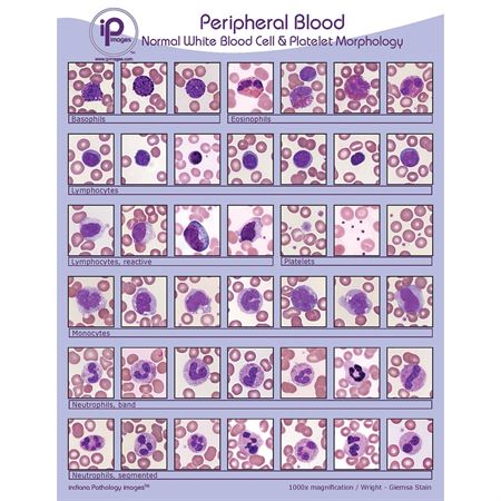 Peripheral Blood Poster Normal White Blood Cell & Platelet Morphology ...