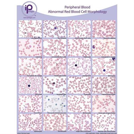Peripheral Blood Cards Platelet Morph & Microorganisms Cards