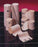 DeRoyal Latex Free Elastic Bandages - Elastic Nonsterile Bandage, 2" x 5 yds. - 9811-25