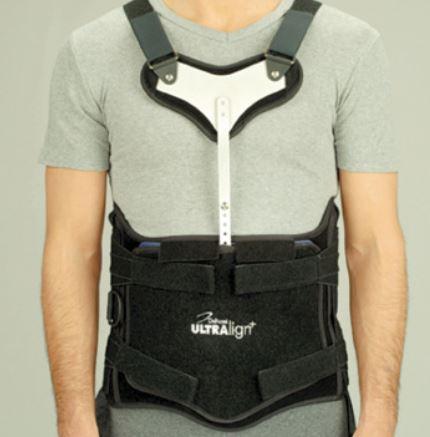 Ultralign + Thoracic Lumbar Sacral Orthothosis by DeRoyal
