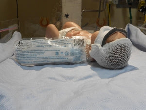 Small Beginnings Bili-Bonnet Photo-Therapy Masks - Bili-Bonnet Photo-Therapy Mask, Newborn - 01B