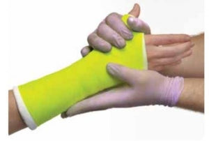 BSN Medical Delta-Lite Conformable Fiberglass Cast - Delta-Lite Conformable Fiberglass Casting Tape, 4" x 4 yd., Orange - 6024