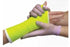BSN Medical Delta-Lite Conformable Fiberglass Cast - Delta-Lite Conformable Fiberglass Casting Tape, 4" x 4 yd., Orange - 6024