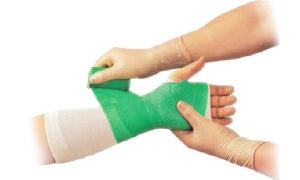 BSN Medical Delta-Cast Elite Polyester Cast Tapes - Delta Polyester Ca ...