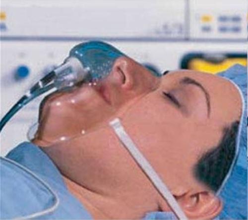 Capnoxygen EtCO2-O2 Sampling Masks by Sharn
