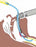 SunMed Adult Ported Introducers - Introducers, Adult Ported Introducer, 15 Fr x 70 cm - 9-0212-80