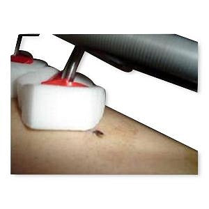 Smith & Nephew Ilizarov Soft and Dry Sponge - Soft and Dry Ilizarov Sponge, 2" Dia. - 102140