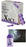 Solstice Corp Xact Imaging Markers - Xact BB Marker for 2D Mammo and X-ray, 1.5 mm Metal - M15S