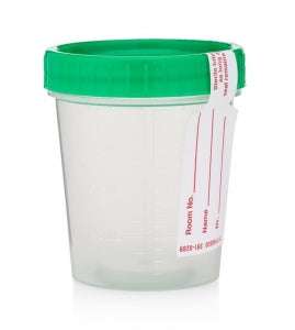 Statlab Medical Products Screw Top Urine Specimen Container - CUP, URI ...