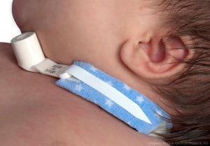 Dale Medical PediPrints Tracheostomy Tube Holder - 242 PediPrints 2-Piece Tracheostomy Tube Holder, 9