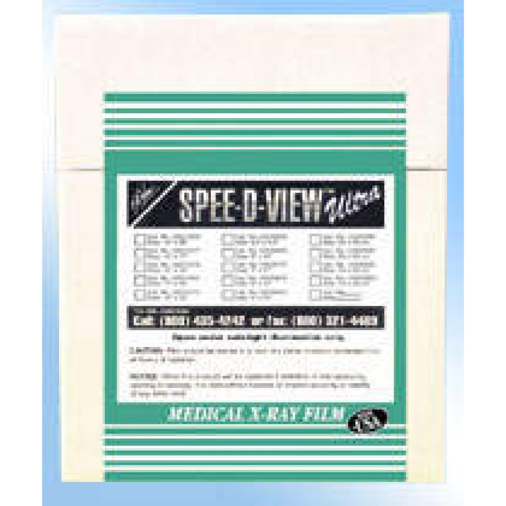 Green Sensitive 7" X 17" 100 Sheets/Box
