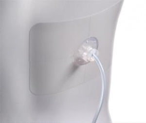 UreSil Tru-Fix Catheter Patch Replacement - Tru-Flex Catheter Adhesive Patch, Dressing Replacement - TFD-R