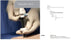 Covidien VersaStep Plus Cannula Dilator - Dilator Cannula, Radially Expandable Sleeve, 10 mm - S101010
