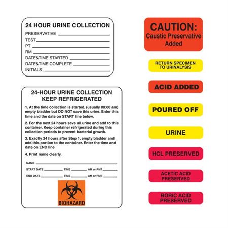 Urine Collection Labels POURED OFF" - Yellow with black text - 1.625"W x 0.375"H