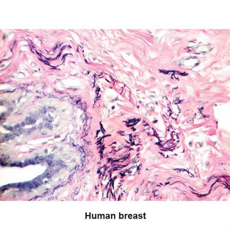 Verhoeff Elastic Stain Set 100mL Set