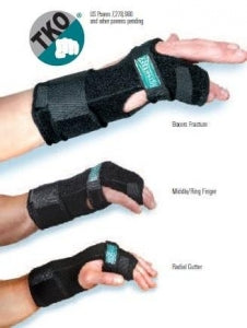 Hely and Weber TKO (The Knuckle Orthosis) - TKO (The Knuckle Orthosis), Right, Regular - 3848-RT