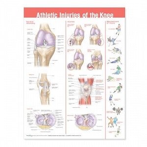 Wolters Kluwer Athletic Injuries of the Knee Anatomical Chart - Athletic Injuries of the Knee Anatomical Chart, Paper - 9780781786720