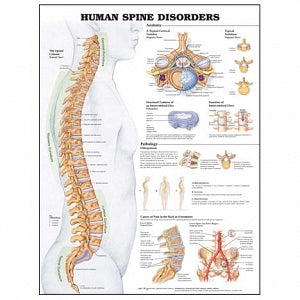 Wolters Kluwer Human Spine Disorders Anatomical Chart - Human Spine Disorders Anatomical Chart, Paper - 9781587793998