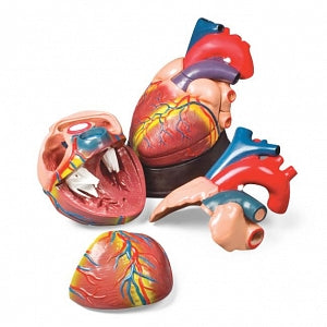 Wolters Kluwer Heart Models - Budget Jumbo Heart Model - CH3