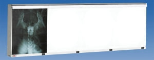 Wolf X-Ray The Econoline Illuminators - X-Ray Econoline Illuminator, 4-in-1 Horizontal - 29604
