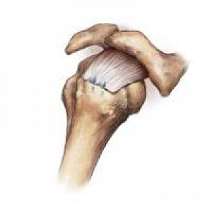 Zimmer Biomet JuggerKnot Soft Anchor - JuggerKnot Soft 1.45 mm Long Anchor Loaded with Single No. 1 MaxBraid Suture - 916030