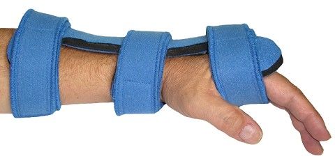 Comfyprene Splint Dorsal Hand Orthosis