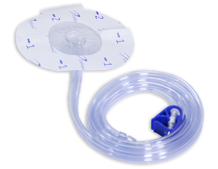 Negative Pressure Wound Therapy