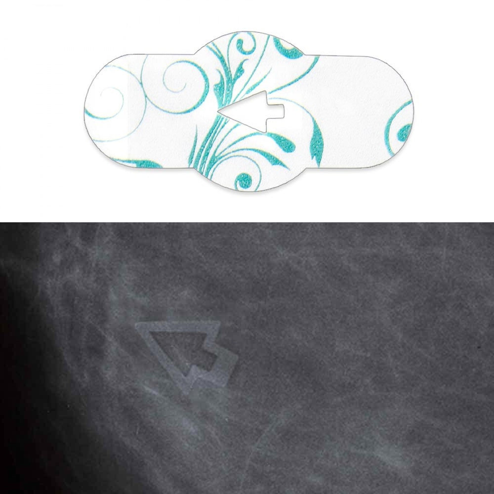 3D Digital Breast Tomosynthesis Soft Mark Single Density Radiolucent 100 Per Box