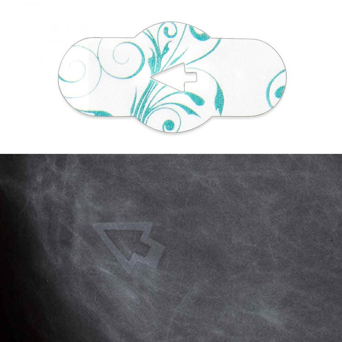 3D Digital Breast Tomosynthesis Soft Mark Single Density Radiolucent 100 Per Box