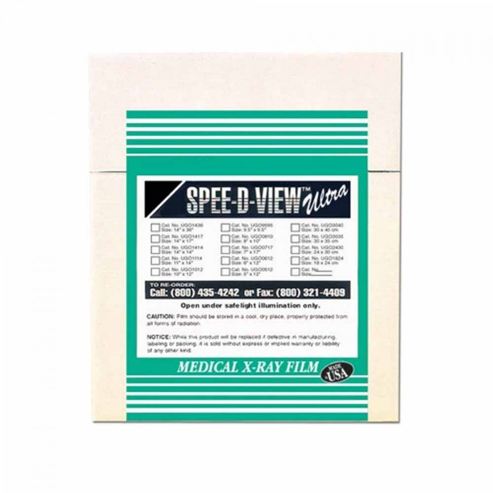 Blue Sensitive 14" X 17" 100 Sheets/Box